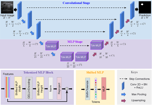 Figure 3 for UNeXt: MLP-based Rapid Medical Image Segmentation Network