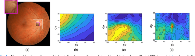 Figure 1 for RetinaMatch: Efficient Template Matching of Retina Images for Teleophthalmology