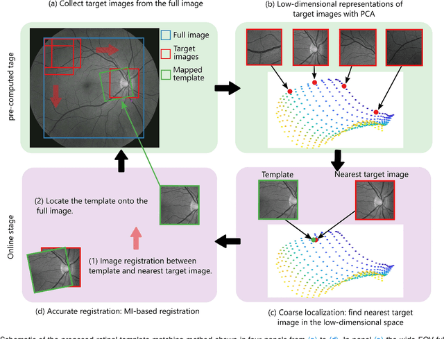 Figure 2 for RetinaMatch: Efficient Template Matching of Retina Images for Teleophthalmology