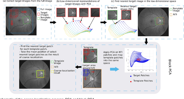 Figure 3 for RetinaMatch: Efficient Template Matching of Retina Images for Teleophthalmology
