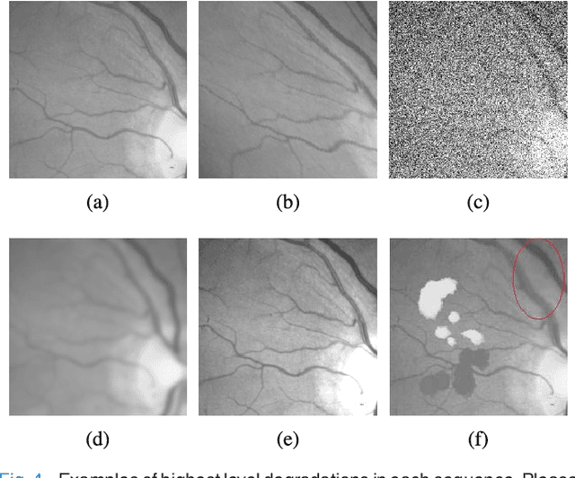 Figure 4 for RetinaMatch: Efficient Template Matching of Retina Images for Teleophthalmology