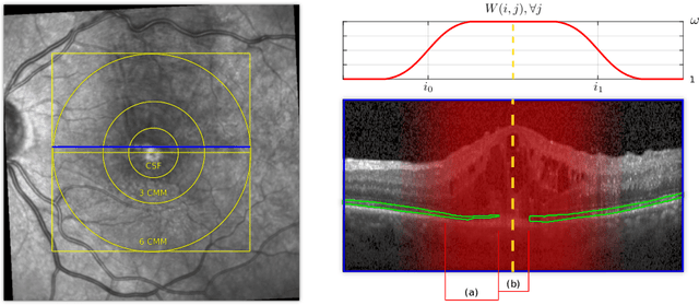 Figure 1 for An amplified-target loss approach for photoreceptor layer segmentation in pathological OCT scans