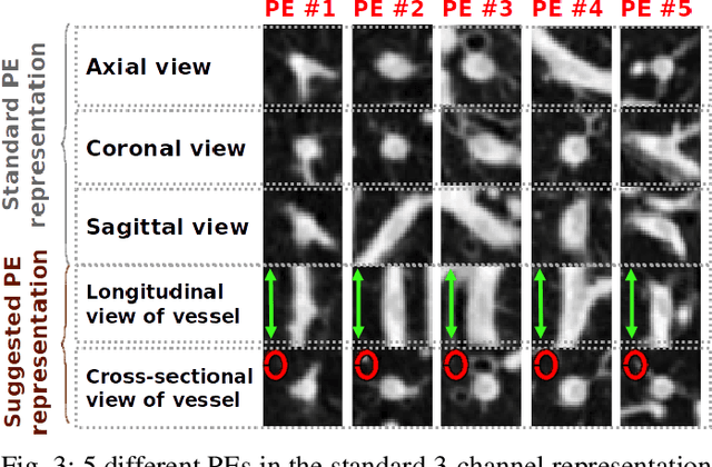 Figure 4 for Convolutional Neural Networks for Medical Image Analysis: Full Training or Fine Tuning?