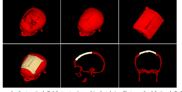 Figure 3 for An Online Platform for Automatic Skull Defect Restoration and Cranial Implant Design