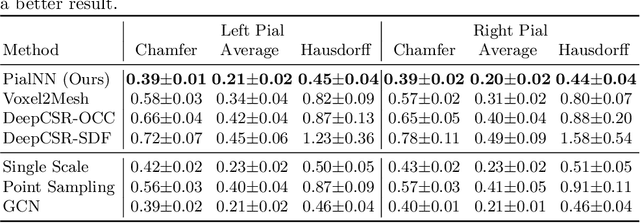 Figure 2 for PialNN: A Fast Deep Learning Framework for Cortical Pial Surface Reconstruction