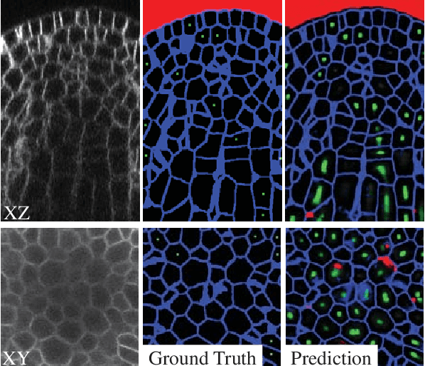 Figure 3 for CNN-based Preprocessing to Optimize Watershed-based Cell Segmentation in 3D Confocal Microscopy Images
