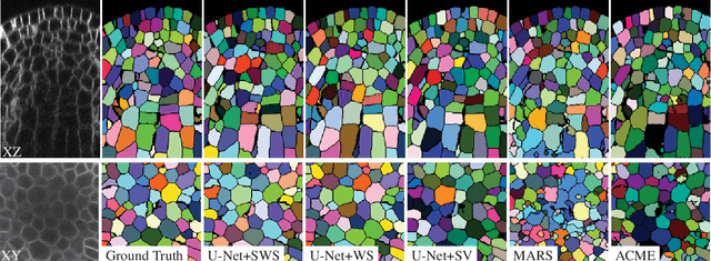 Figure 4 for CNN-based Preprocessing to Optimize Watershed-based Cell Segmentation in 3D Confocal Microscopy Images