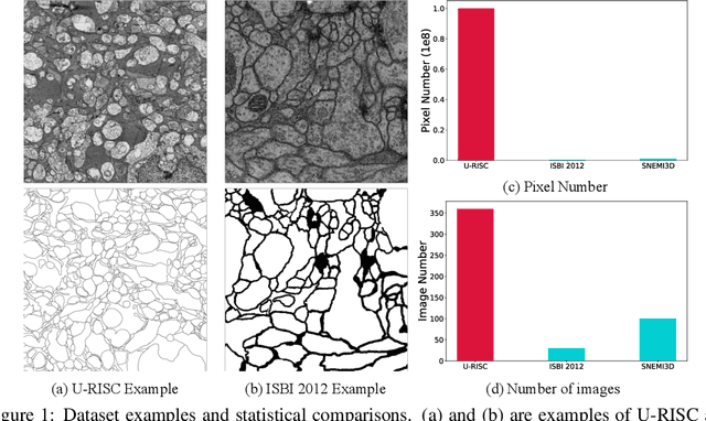 Figure 1 for Human Perception-based Evaluation Criterion for Ultra-high Resolution Cell Membrane Segmentation