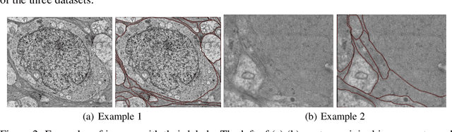 Figure 3 for Human Perception-based Evaluation Criterion for Ultra-high Resolution Cell Membrane Segmentation