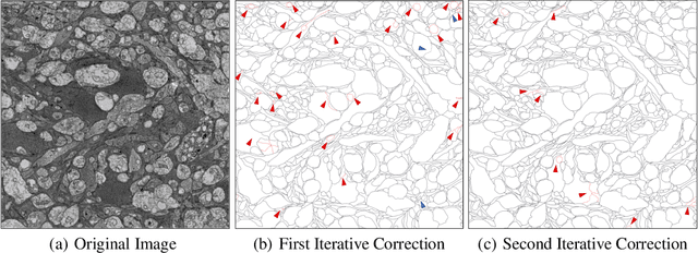 Figure 4 for Human Perception-based Evaluation Criterion for Ultra-high Resolution Cell Membrane Segmentation