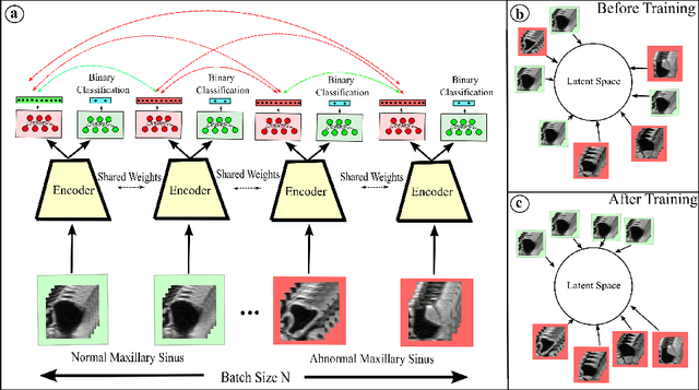 Figure 1 for Supervised Contrastive Learning to Classify Paranasal Anomalies in the Maxillary Sinus