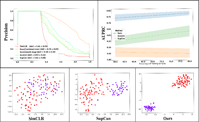 Figure 4 for Supervised Contrastive Learning to Classify Paranasal Anomalies in the Maxillary Sinus