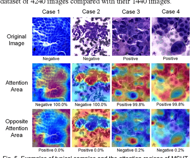 Figure 3 for MSHT: Multi-stage Hybrid Transformer for the ROSE Image Analysis of Pancreatic Cancer