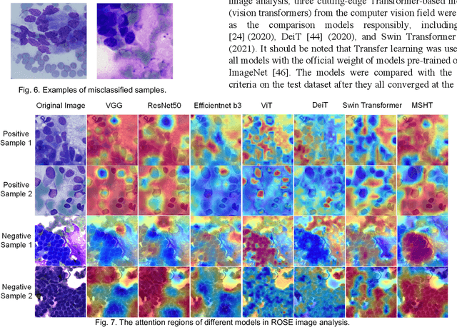 Figure 4 for MSHT: Multi-stage Hybrid Transformer for the ROSE Image Analysis of Pancreatic Cancer