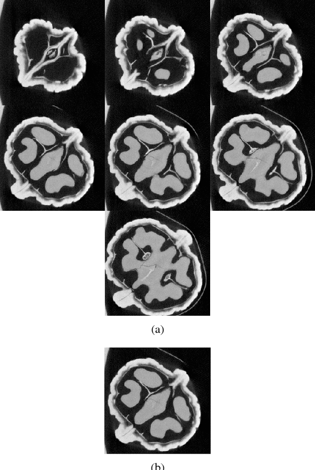 Figure 1 for Tomographic Reconstruction using Global Statistical Prior