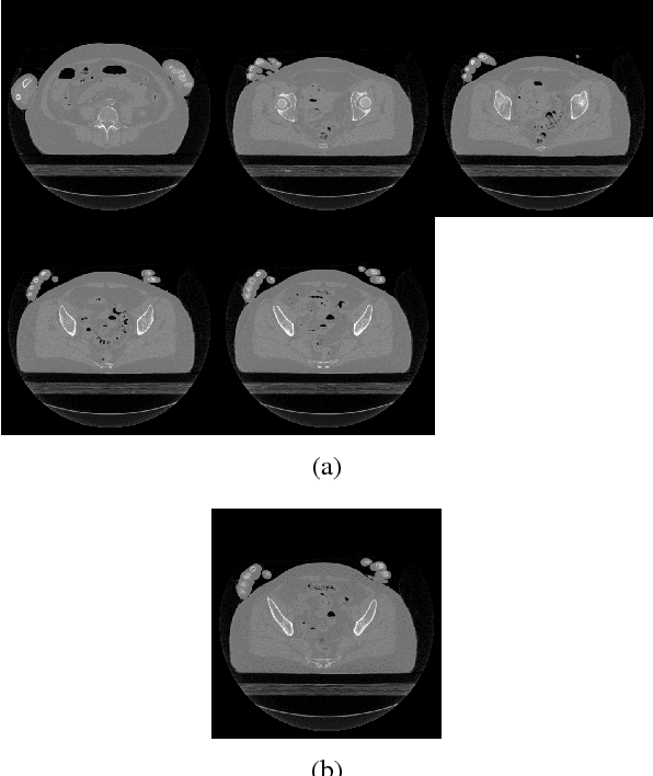 Figure 2 for Tomographic Reconstruction using Global Statistical Prior