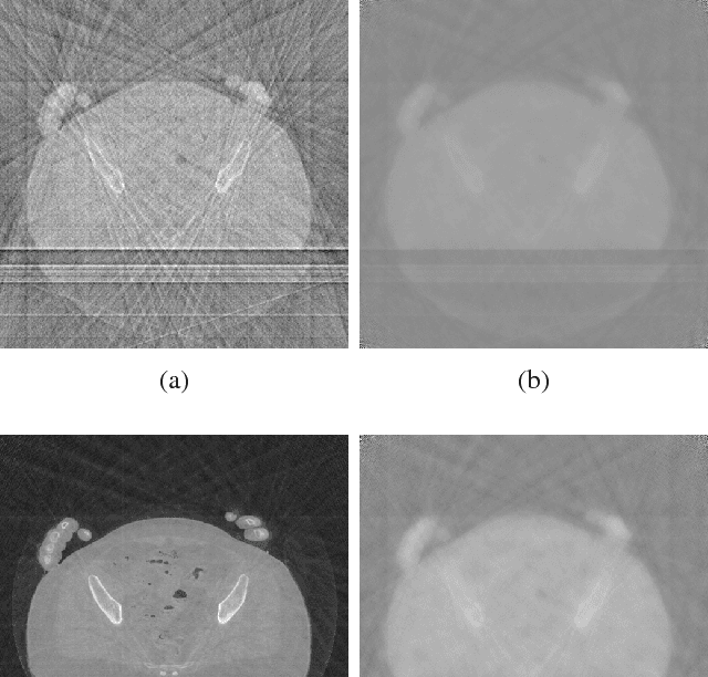 Figure 3 for Tomographic Reconstruction using Global Statistical Prior