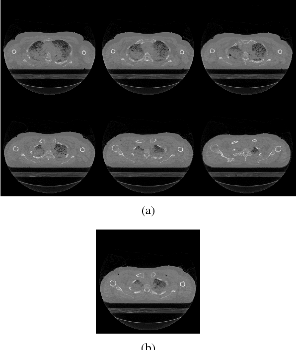 Figure 4 for Tomographic Reconstruction using Global Statistical Prior