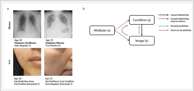 Figure 1 for Detecting and Preventing Shortcut Learning for Fair Medical AI using Shortcut Testing (ShorT)