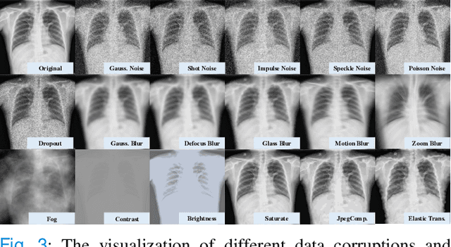 Figure 3 for Towards to Robust and Generalized Medical Image Segmentation Framework