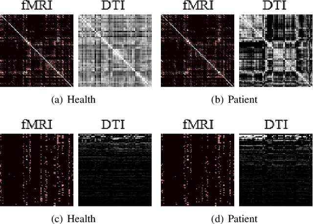 Figure 3 for Multiplex Graph Networks for Multimodal Brain Network Analysis