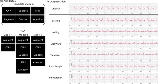 Figure 2 for A Multi-View Learning Approach to Enhance Automatic 12-Lead ECG Diagnosis Performance
