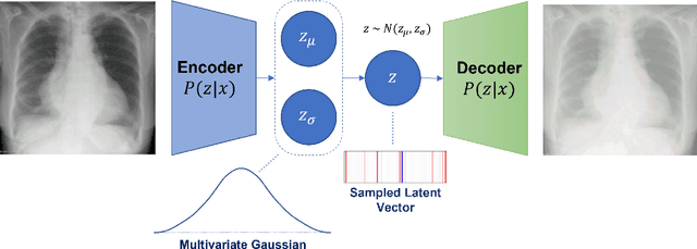 Figure 4 for CheXstray: Real-time Multi-Modal Data Concordance for Drift Detection in Medical Imaging AI