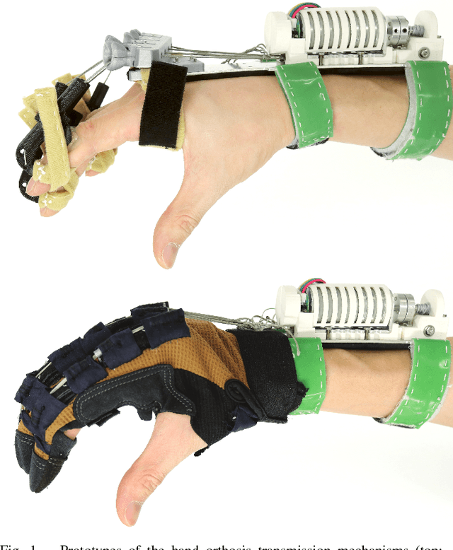 Figure 1 for Design and Development of Effective Transmission Mechanisms on a Tendon Driven Hand Orthosis for Stroke Patients