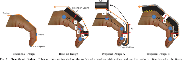 Figure 2 for Design and Development of Effective Transmission Mechanisms on a Tendon Driven Hand Orthosis for Stroke Patients