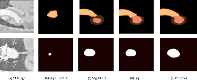 Figure 4 for Unsupervised Domain Adaptation Network with Category-Centric Prototype Aligner for Biomedical Image Segmentation