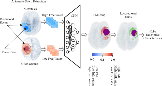 Figure 1 for Artificial intelligence-based locoregional markers of brain peritumoral microenvironment