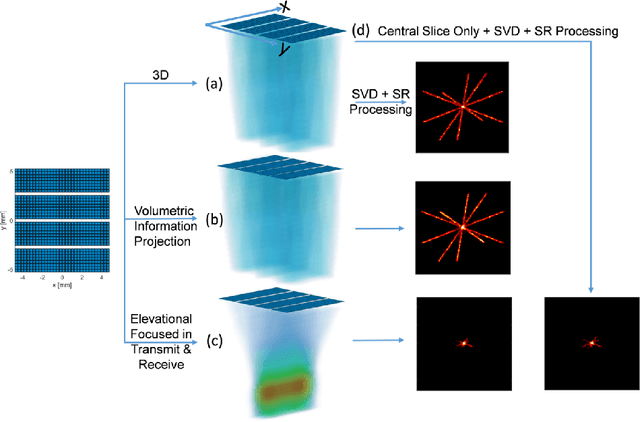 Figure 1 for Volumetric Image Projection Super-Resolution Ultrasound (VIP-SR) with a 1D Unfocused Linear Array