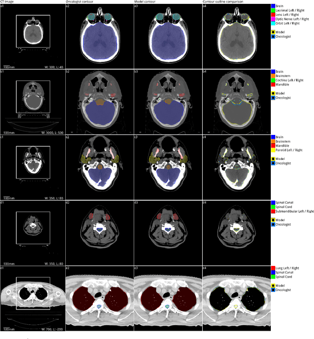 Figure 3 for Deep learning to achieve clinically applicable segmentation of head and neck anatomy for radiotherapy