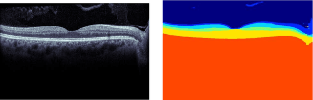 Figure 2 for Deep Learning based Retinal OCT Segmentation
