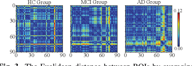 Figure 3 for Interpretable Graph Convolutional Network of Multi-Modality Brain Imaging for Alzheimer's Disease Diagnosis