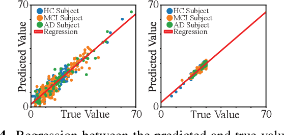 Figure 4 for Interpretable Graph Convolutional Network of Multi-Modality Brain Imaging for Alzheimer's Disease Diagnosis