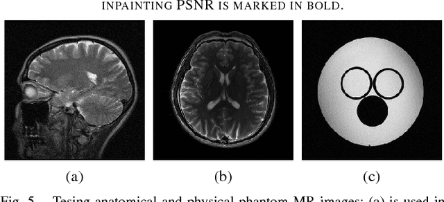 Figure 4 for The Power of Complementary Regularizers: Image Recovery via Transform Learning and Low-Rank Modeling