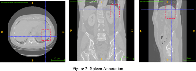 Figure 2 for Organ localisation using supervised and semi supervised approaches combining reinforcement learning with imitation learning