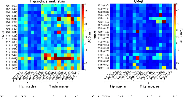 Figure 4 for Automated Muscle Segmentation from Clinical CT using Bayesian U-Net for Personalization of a Musculoskeletal Model