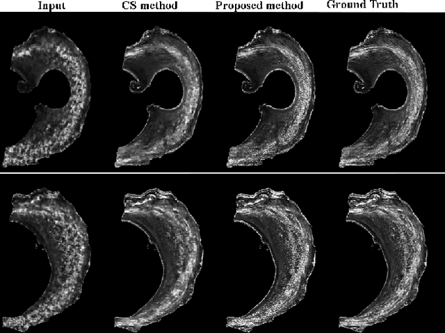Figure 1 for Self-Learned Kernel Low Rank Approach TO Accelerated High Resolution 3D Diffusion MRI