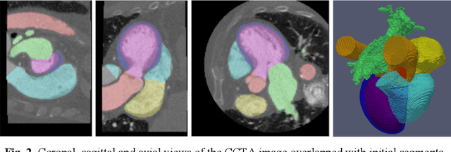 Figure 3 for Whole Heart Anatomical Refinement from CCTA using Extrapolation and Parcellation