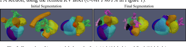 Figure 4 for Whole Heart Anatomical Refinement from CCTA using Extrapolation and Parcellation