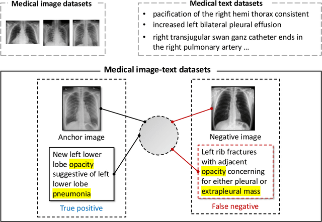 Figure 3 for MedCLIP: Contrastive Learning from Unpaired Medical Images and Text