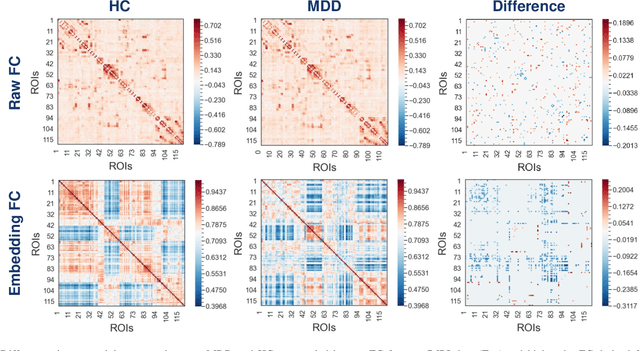 Figure 4 for Graph Autoencoders for Embedding Learning in Brain Networks and Major Depressive Disorder Identification