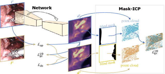 Figure 1 for Self-Supervised Depth Estimation in Laparoscopic Image using 3D Geometric Consistency