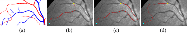 Figure 1 for Trajectory Grouping with Curvature Regularization for Tubular Structure Tracking