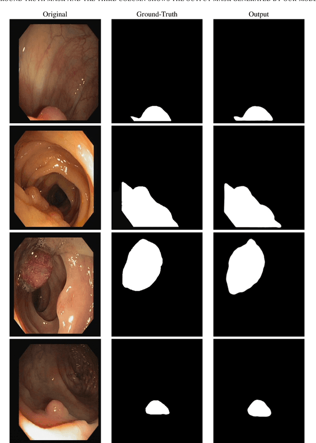 Figure 4 for Enhanced U-Net: A Feature Enhancement Network for Polyp Segmentation