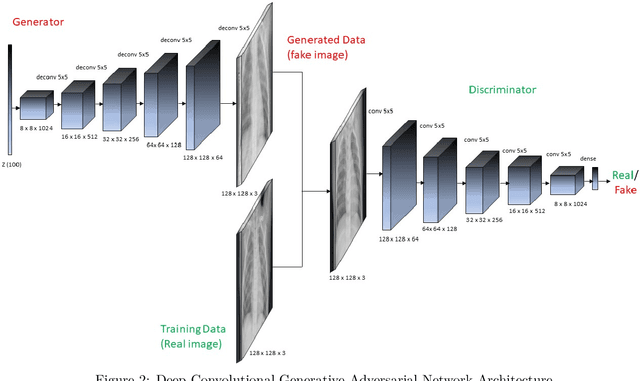 Figure 2 for Evaluation of Deep Convolutional Generative Adversarial Networks for data augmentation of chest X-ray images
