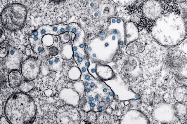 Figure 3 for Automatic Detection of Coronavirus Disease (COVID-19) in X-ray and CT Images: A Machine Learning-Based Approach