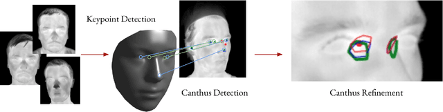 Figure 1 for Inner Eye Canthus Localization for Human Body Temperature Screening